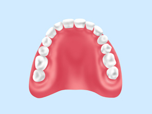 入れ歯の種類（自費治療）